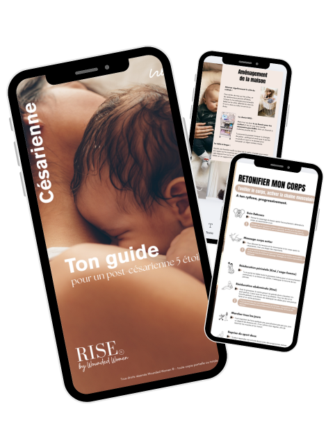 Guide de référence Post-Césarienne